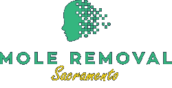 Mole Removal Sacramento | Scarless Mole Removal Logo