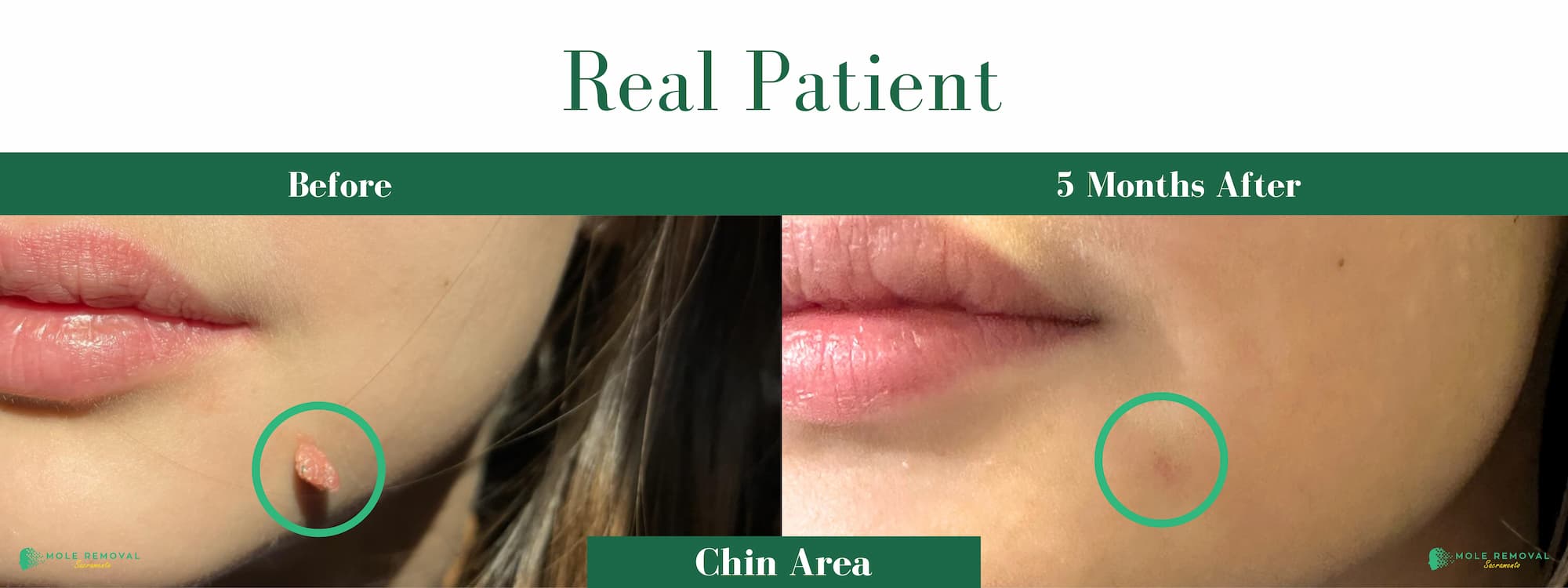 SAC New before_after #12