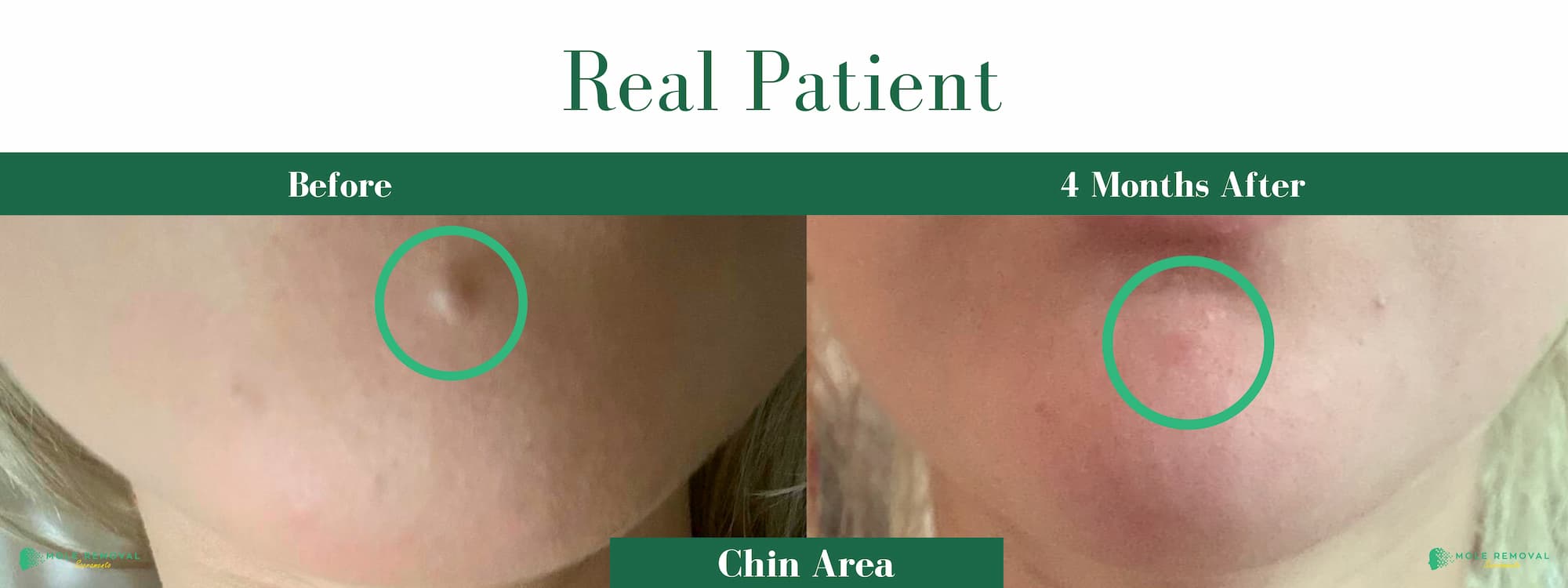 SAC New before_after #13 (1)