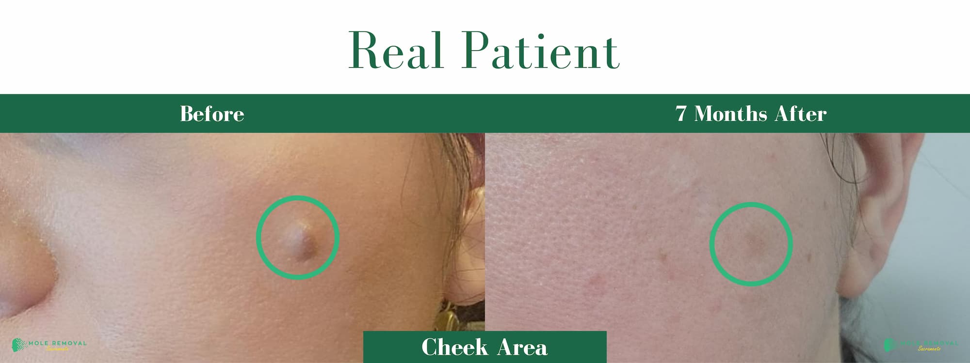 SAC New before_after #15