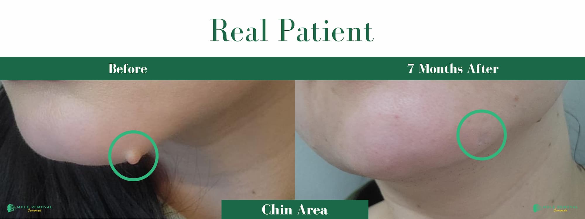 SAC New before_after #16