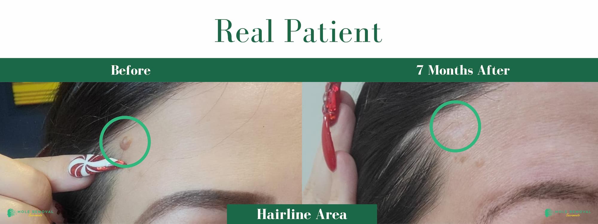 SAC New before_after #17