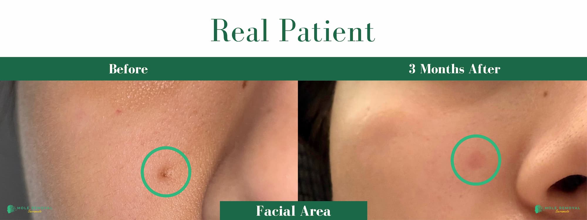 SAC New before_after #18