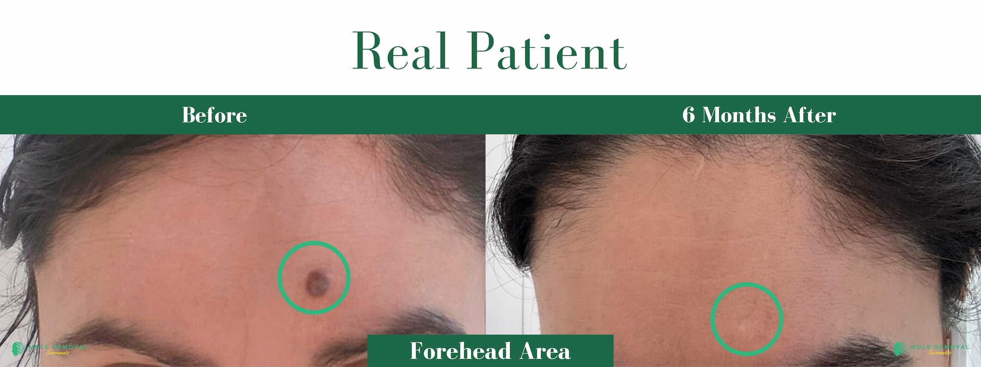 SAC New before_after #20